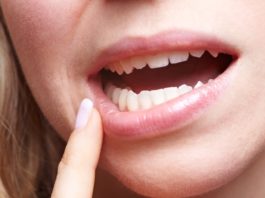 Aftas- Dentista Zona Sul Rj