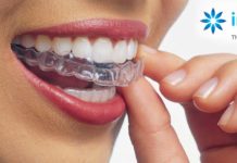 Aparelho Invisalign