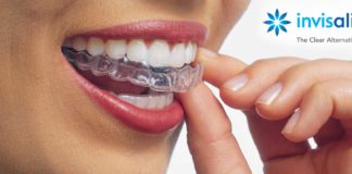 Aparelho Invisalign