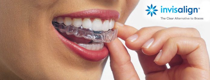 Aparelho Invisalign