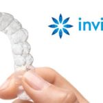 Aparelho Invisalign