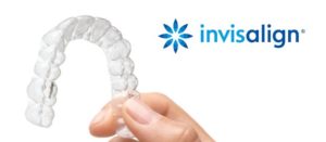 Aparelho Invisalign